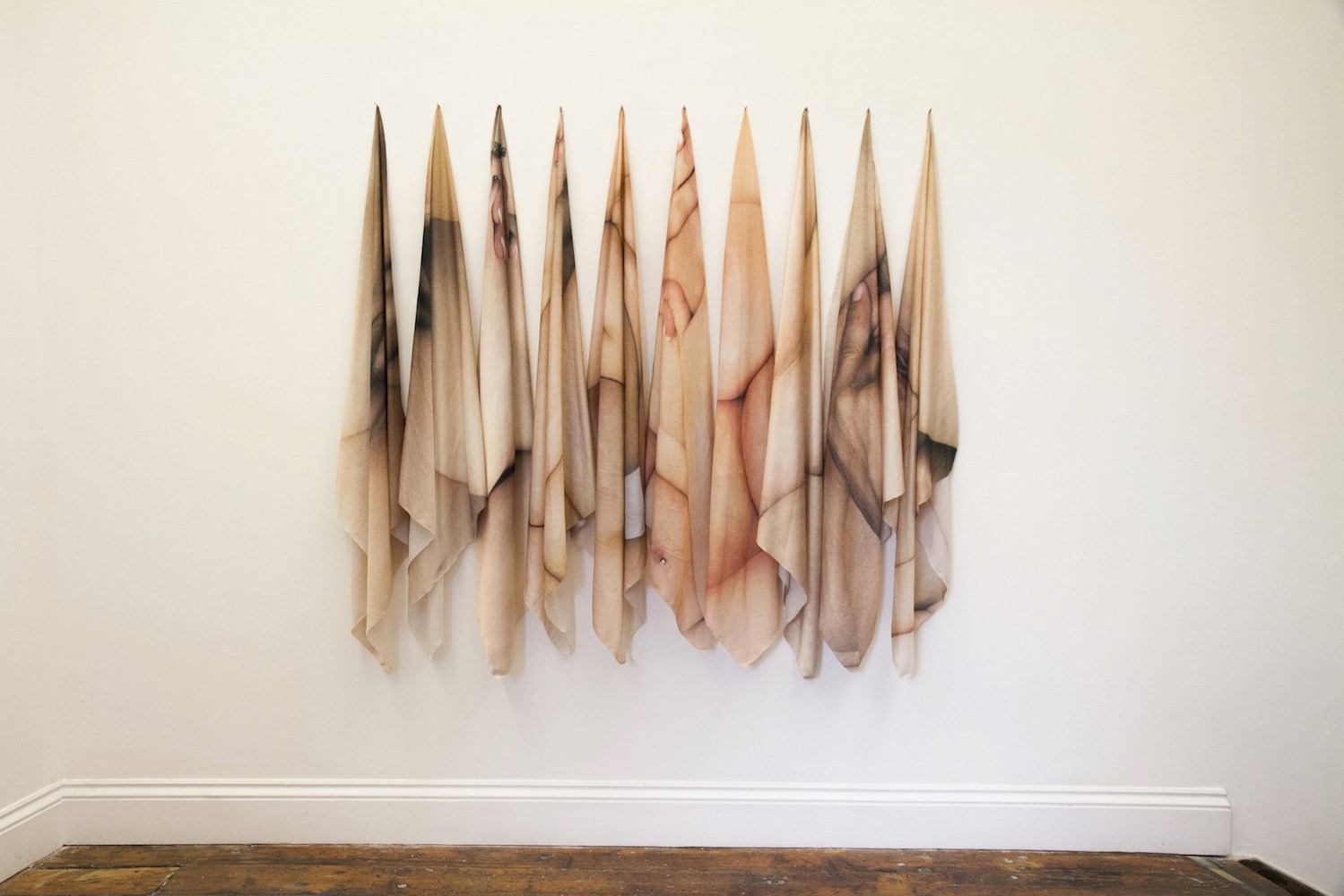 The Body is Victory and Defeat of Dreams || Lesvos